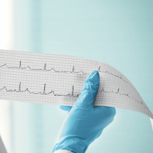 cardiologo-cdmx-dr-galo-javier-delgado-tratamiento